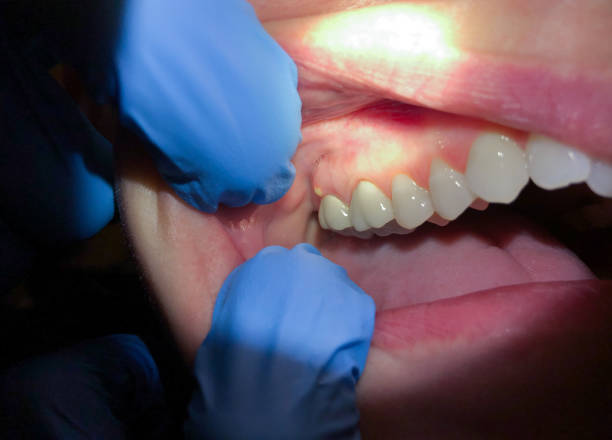 Best Pediatric Emergency Dentist in Comstock Northwest, MI