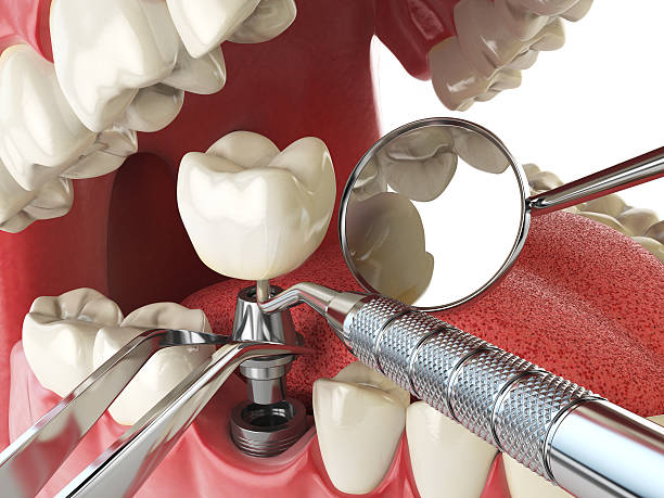 Best Emergency Dental Extractions in Comstock Northwest, MI